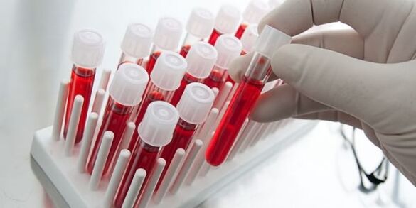 blood test