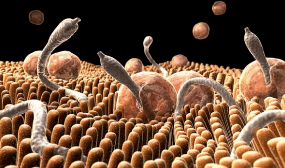 Parasites in the human body